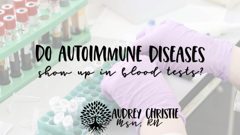 do autoimmune diseases show up in blood tests